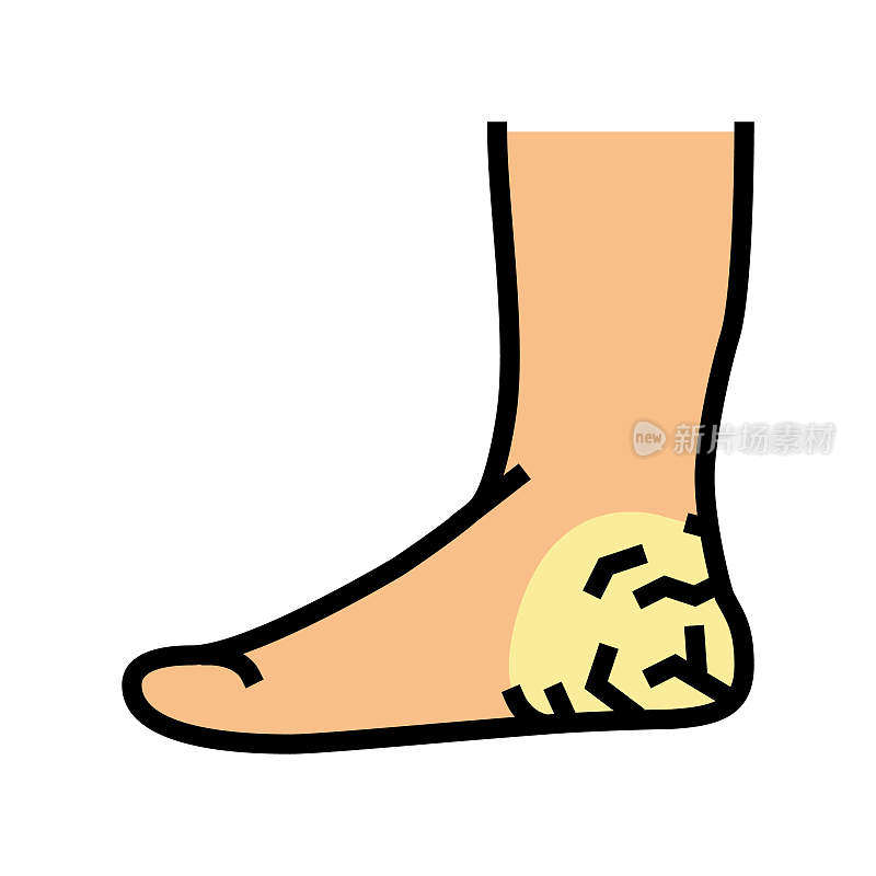 heels dry skin color icon vector illustration